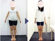 美デザイン 銀座店(美.design)/☆美脚Ｏ脚+美尻骨盤+お腹くびれ