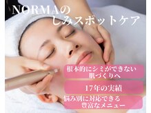 ノーマ(NORMA)