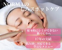 ノーマ(NORMA)
