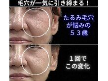 40分後のビフォーアフター写真はフォトギャラリーに多数掲載中☆