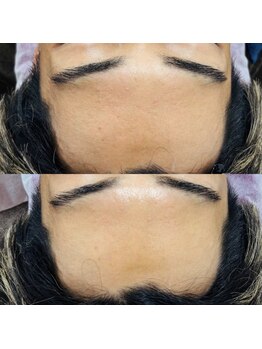 トゥインクル(Twinkle)/メンズだって美しく♪