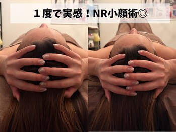 リ ビューティ リバティ(Re:Beauty LIBERTY)の写真/顔の大きさに悩んでる方必見!一度の施術で驚きの効果◎