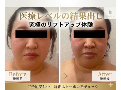 レミュ(Remu)の写真