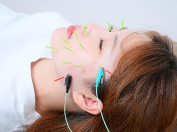 SUGIMOTO LAB'【肩こり/腰痛/美容鍼/鍼灸/マタニティ/産後/骨盤矯正/マッサージ】/美容鍼