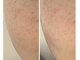リッチベル(richbelle)の写真