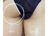 【先着5名限定】女性人気No1！浮腫と痩身と美尻セット¥11,000→¥6,000