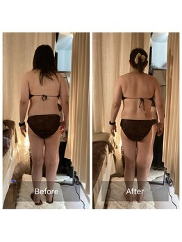 ラ ブリエ(La Briller)/痩身コース!短期集中1ヶ月☆