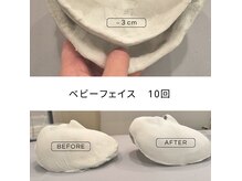 薬手名家 新宿店の雰囲気（コースを組んでいただいたお客様は石膏パックでの比較も行います）