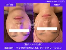 フェレザ 新潟(Felleza)/お好きな美容液持参OKです！