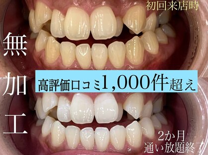 札幌セルフホワイトニング ラディアンス(Radiance)の写真