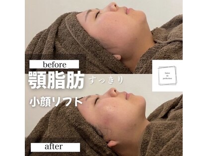 サロン ド パーフェクション(Salon de Perfection)の写真
