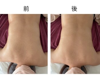 カリアンヌ/身体のゆがみにリンパマッサージ