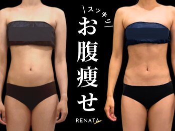 レナータ 新宿店(RENATA)