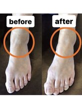 カワル整体 上通り院/外反/母趾改善のための秘訣