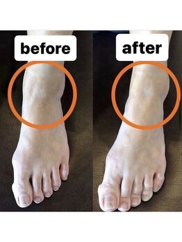 カワル整体 上通り院/外反/母趾改善のための秘訣