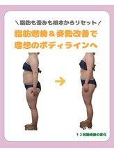 メリーオーシャンズ(merry ocean’s)/ダイエットコース１２回施術例