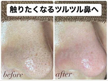 ミー(美mee)の写真