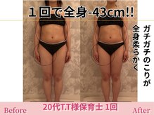 アメリイ 百合ヶ丘 新百合ヶ丘(Amerii)/【20代痩身】1回全身-43.1cm痩せ