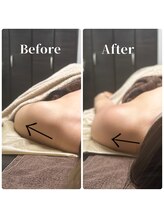フィール(feel)/整体＋リンパ　Before & After