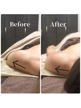 フィール(feel)/整体+リンパ Before & After
