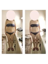 アクア エステティコ 亀有(ACQUA estetico)/脂肪燃焼　3ヶ月変化　50代