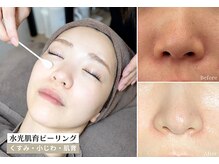 スリースリー 恵比寿(THREE THREE)の雰囲気（人気No.1【水光ピーリング】透明感あるツヤ肌になりたいなら）