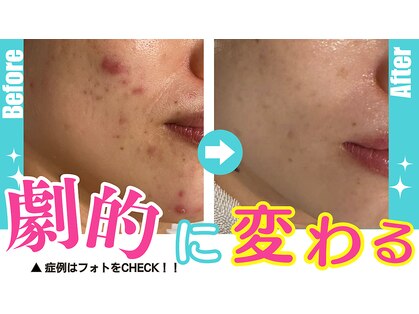 アドビューティ(Add Beauty)の写真