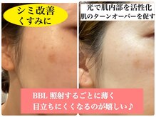 ぶっちょシャイン(ぶっちょShine)/透明感UP｜シミケア・くすみに◎