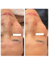 ラディエンス 多治見店/マーメイドセルエステ