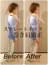 ティーエスエル とがし整体ラボ(TSL とがし整体 Labo)/ブライダル整体/骨盤矯正/反り腰