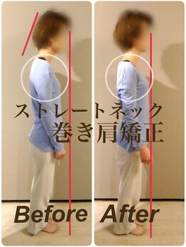 ティーエスエル とがし整体ラボ(TSL とがし整体 Labo)/ブライダル整体/骨盤矯正/反り腰