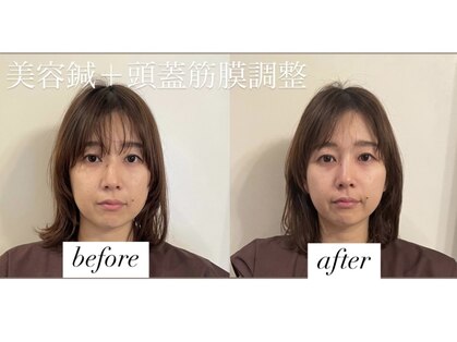 ヤマモト 表参道院(YAMAMOTO)の写真