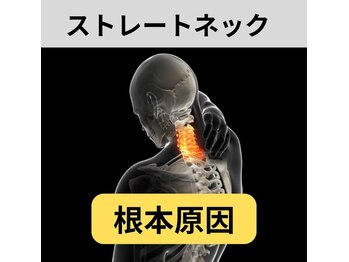 カワル整体 長嶺院/ストレートネック