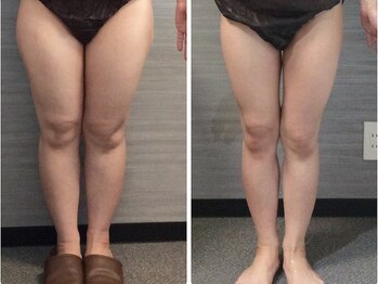 ウェリナ平和堂長久手院/小顔矯正/骨盤矯正/美脚サロン