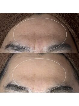 ソワ 吉塚店(soi)/老けた?って言われた肌にも!