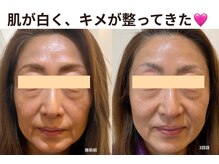 チョチョワンプラス(緒々one+)の雰囲気（【肌年齢-5歳】幹細胞フェイシャルで叶える若見え肌）