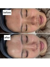 ラウラウ(laulau)/ララピール