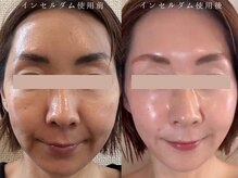 シェリ フルール(Cheri Fleur)の雰囲気(韓国発の最先端コスメ使用★見違えるほどの変化!使用方法が鍵◎)