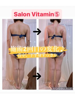 サロン ビタミンファイブ(Salon Vitamin5)/モニター様変化お写真です♪