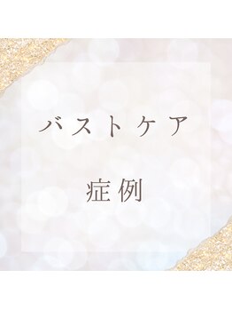 サロンツキ(salon tuki)/バストケア症例