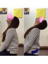 ヒデ整体院(Hide整体院)/猫背矯正骨盤矯正B/A肩こり腰痛