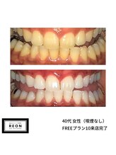 レオン 磐田(REON)/◇ お客様 before＆after ◇