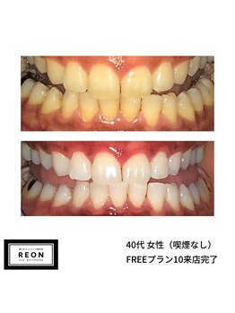 レオン 磐田(REON)/◇ お客様 before＆after ◇