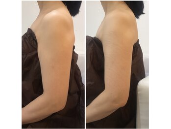 ブリランテ(Brillante)/