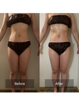 フィエルテ 甲斐敷島(FIERTE)/お客様beforeafter