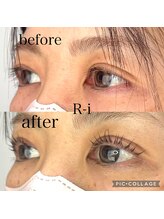 アールアイ(R-i)/アイリッドアップパーマ