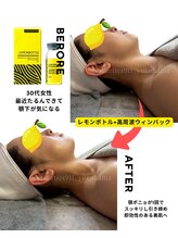 エステティックス ナインワンワン 横浜(Esthetics911) /レモンボトルで小顔リフトアップ