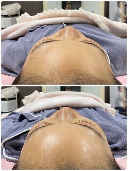 アリス(Alice)/感動級の小顔