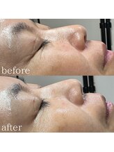 エメリーヌ(AIMELINE)/クリスティーナ　フォーエバー