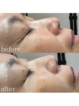 エメリーヌ(AIMELINE)/クリスティーナ フォーエバー